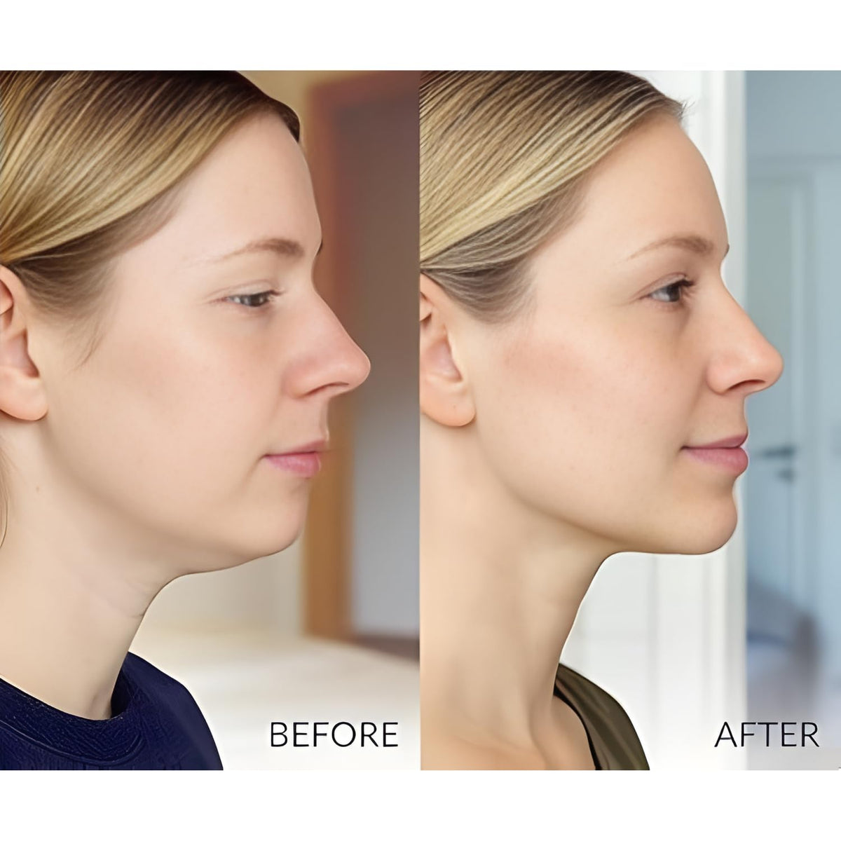 Deep Collagen V Lifting Gel Mask | Double-chin Mask | Instant Cooling & Depuffing | Face Toning Belt | Jawline Shaper Face Lift | Collagen V-line | Improves Sagging Skin, Lifting & Firming | Chin Strap for Women & Men (1)