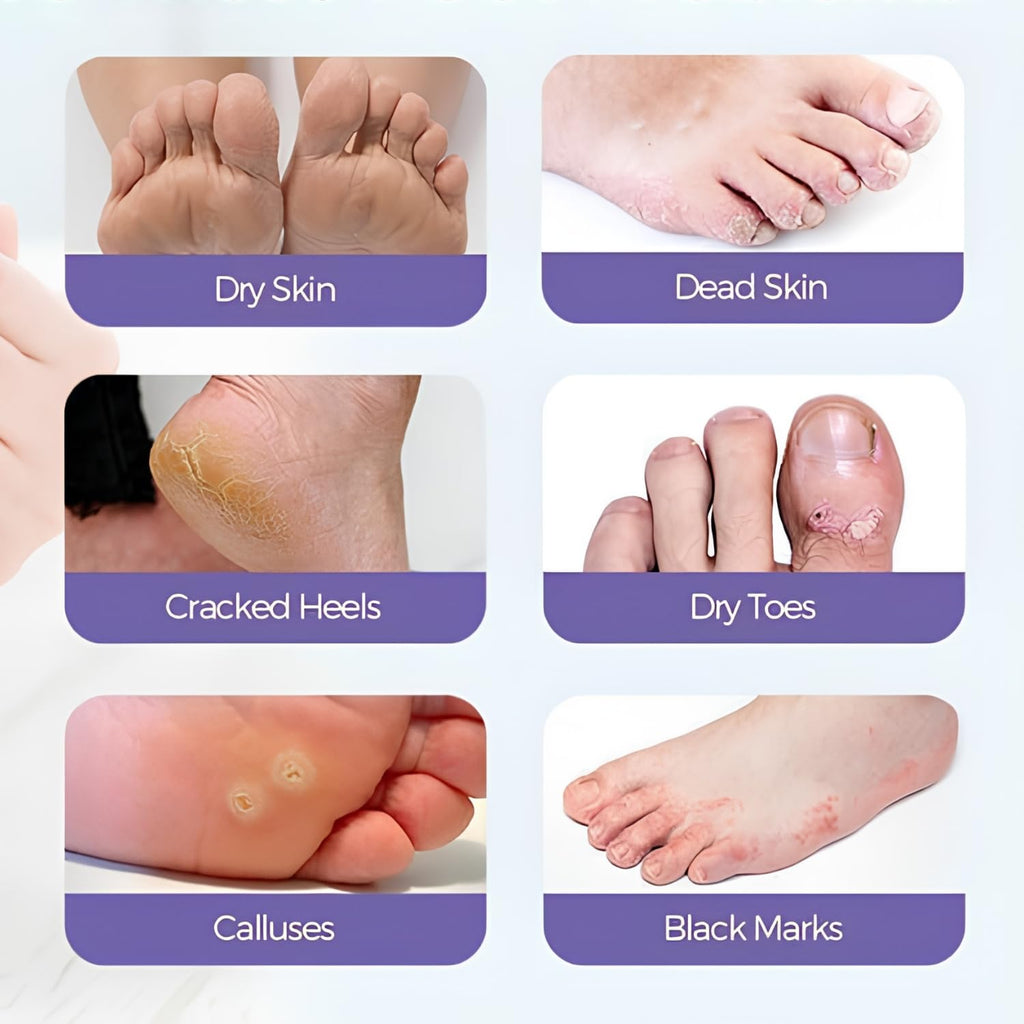 Foot Peeling Mask (1 Pair), Korean Peeling & Exfoliating with Glycolic Acid, Removes Dead Skin, Cruelty-Free, Goat Milk Foot Mask for Deep Exfoliation and Moisturizing