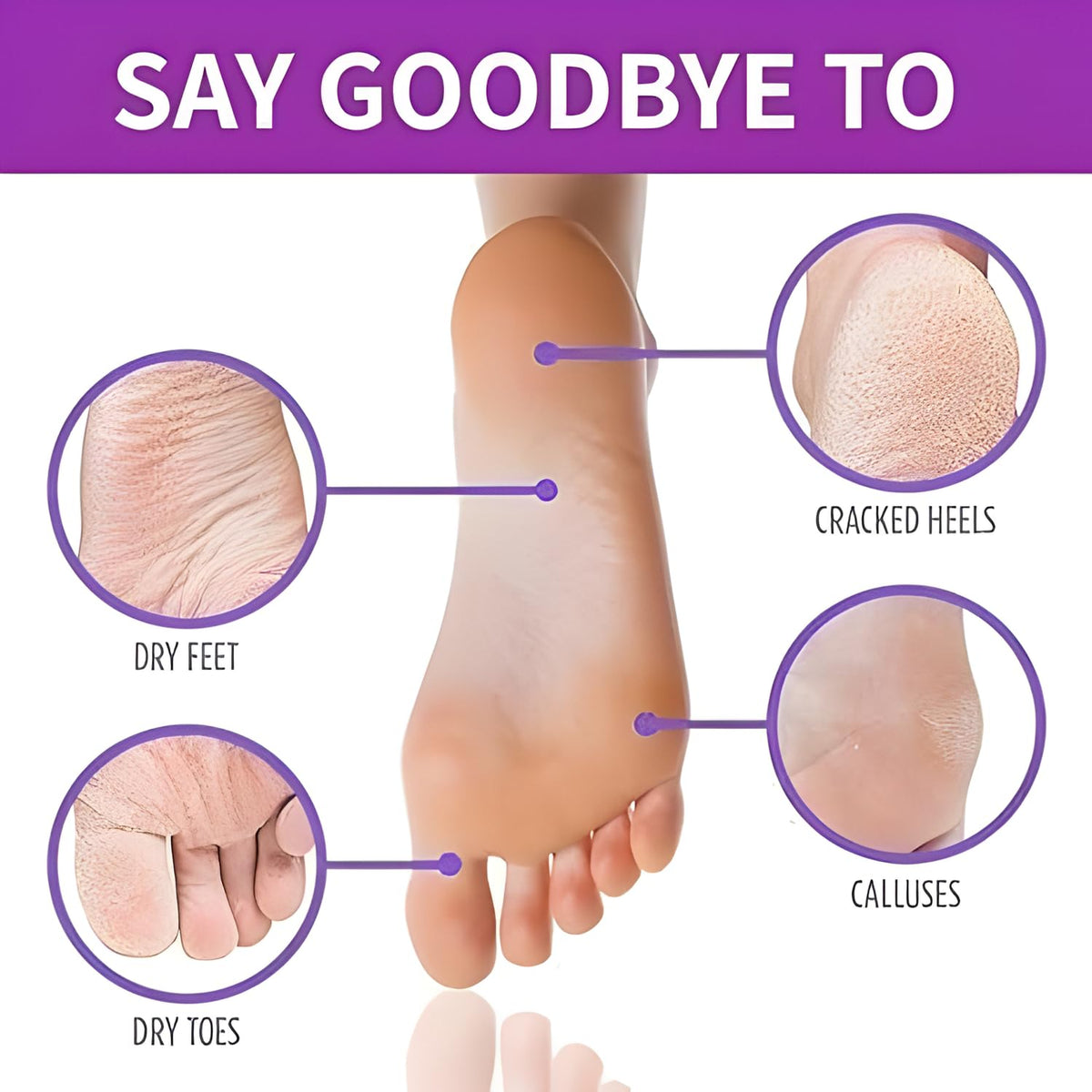 Foot Peeling Mask (1 Pair), Korean Peeling & Exfoliating with Glycolic Acid, Removes Dead Skin, Cruelty-Free, Goat Milk Foot Mask for Deep Exfoliation and Moisturizing